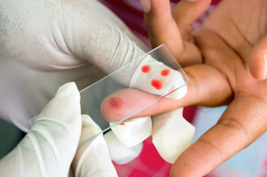 University of Lagos Develops Breakthrough Malaria Treatment