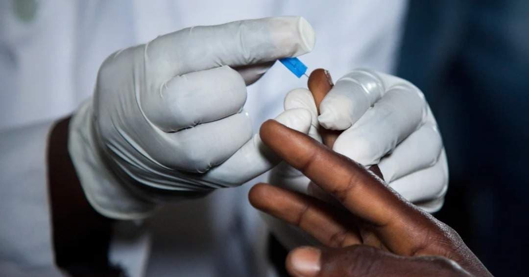 FG Launches 2026-2030 HIV Plan to cut Donor Reliance