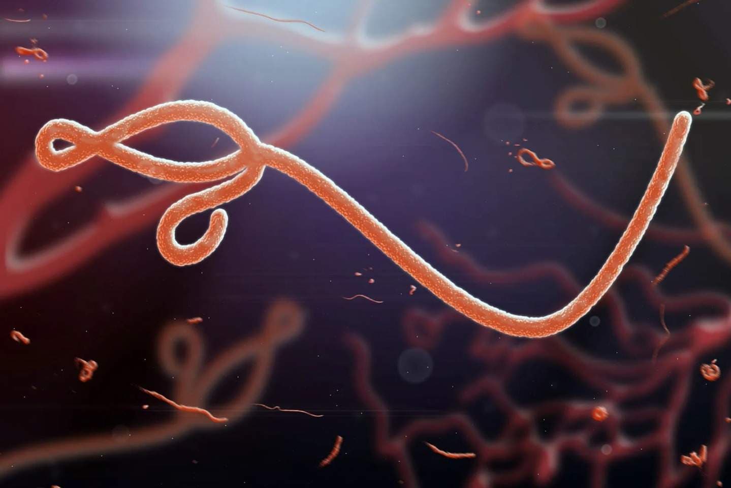 France Confirms First Ebola Case on Home Soil